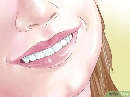 Як вирівняти зуби без брекетів, використовуючи invisalign (зуби) Як вирівняти зуби без брекетів, використовуючи invisalign