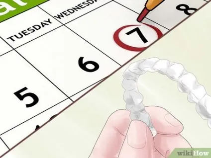 Як вирівняти зуби без брекетів, використовуючи invisalign (invisalign) Як вирівняти зуби без брекетів, використовуючи invisalign