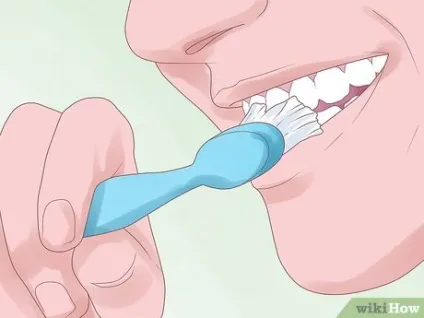 Як вирівняти зуби без брекетів, використовуючи invisalign (брекетів) Як вирівняти зуби без брекетів, використовуючи invisalign