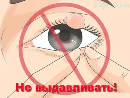 Як вилікувати ячмінь на оці - ефективні народні засоби (ячмінь) Як вилікувати ячмінь на оці - ефективні народні засоби