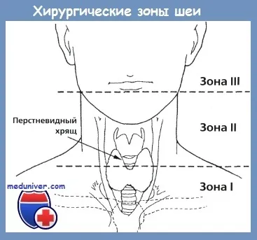 Колоті рани шиї - пошкодження судин (колоті) Колоті рани шиї - пошкодження судин