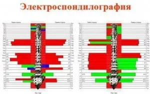 Комплекс комп'ютерної функціональної діагностики хребта - Медіскрін-вертебро - здоров'я для (хребта) Комплекс комп'ютерної функціональної діагностики хребта - Медіскрін-вертебро - здоров'я для