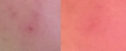 Коректор для прищів airbrush concealer від clinique (airbrush) Коректор для прищів airbrush concealer від clinique
