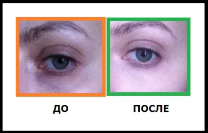 Консилер clinique опис, фото до і після, ефективно (консилер) Консилер clinique опис, фото до і після, ефективно