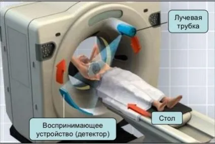 Комп'ютерна томографія хребта і наскільки важливі її переваги