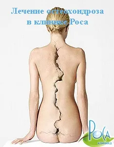 лікування невралгії