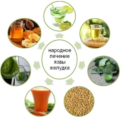 Лікування виразки шлунка народними засобами і методами (народними) Лікування виразки шлунка народними засобами і методами