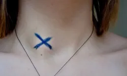 Мастопатія і її вплив чим небезпечна, наслідки (днів початку менструального циклу) Мастопатія і її вплив чим небезпечна, наслідки