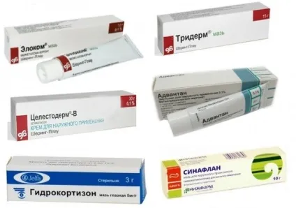 Мазь від алергічного дерматиту види, застосування (мазь) Мазь від алергічного дерматиту види, застосування