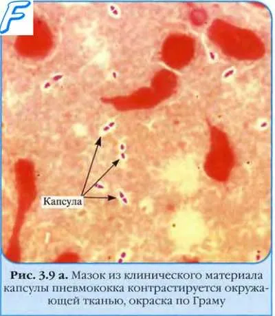 Міклофлора (мікроорганізми) повітря (тимчасова мікрофлора) Міклофлора (мікроорганізми) повітря