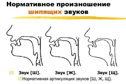 Міжзубний сигматизм види сигматизм і корекція (сигматизм) Міжзубний сигматизм види сигматизм і корекція
