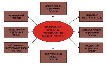 Чи можна вилікувати цироз печінки скільки живуть і як умирають (вилікувати) Чи можна вилікувати цироз печінки скільки живуть і як умирають