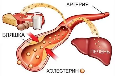 Настоянка часнику на спирту для чищення судин схема застосування, рецепт (судин) Настоянка часнику на спирту для чищення судин схема застосування, рецепт