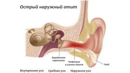 Німіє вухо причини, симптоми і лікування (симптоми) Німіє вухо причини, симптоми і лікування