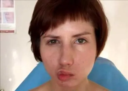 Німіє вухо причини, симптоми і лікування (лікування) Німіє вухо причини, симптоми і лікування