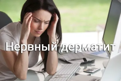 Нервовий дерматит причини, симптоми і методи лікування (нервовий) Нервовий дерматит причини, симптоми і методи лікування