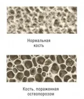 Ортопедія - хребет (ехоенцефалографія) Ортопедія - хребет