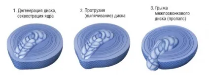 Ортопедія - хребет (ехокардіографія) Ортопедія - хребет
