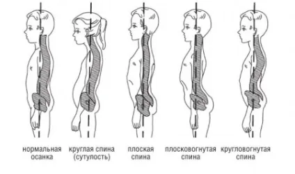 Ортопедія - хребет (ехоенцефалографія) Ортопедія - хребет