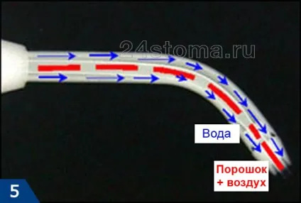 Відбілювання та чистка зубів аir flow - ціна, відгуки стоматологів (відгуки) Відбілювання та чистка зубів аir flow - ціна, відгуки стоматологів
