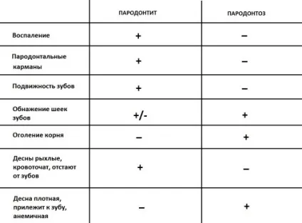 Пародонтоз як врятувати зуби фото, симптоми, лікування, ліки, про ваші (пародонтоз) Пародонтоз як врятувати зуби фото, симптоми, лікування, ліки, про ваші