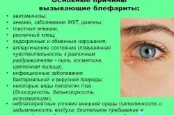 Чому болять повіки очей (око) Чому болять повіки очей