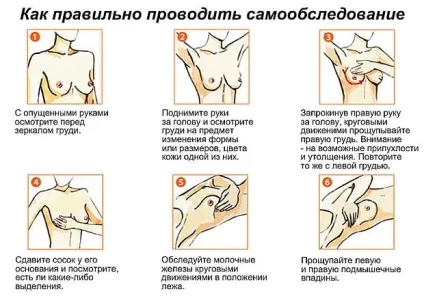 Чому болять соски у дівчат, груди, причини, больові відчуття (соски) Чому болять соски у дівчат, груди, причини, больові відчуття