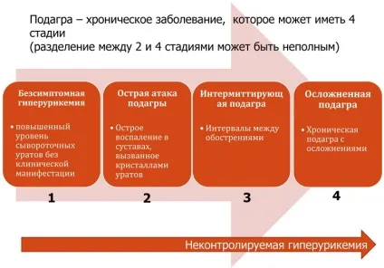 Подагра ознаки і лікування, симптоми, що за хвороба, як лікувати подагру (симптоми) Подагра ознаки і лікування, симптоми, що за хвороба, як лікувати подагру