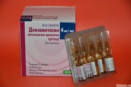 Препарати для лікування остеохондрозу поперекового відділу хребта, призначення лікарів (препарати) Препарати для лікування остеохондрозу поперекового відділу хребта, призначення лікарів