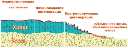 Причини захворювання суглобів (причини) Причини захворювання суглобів