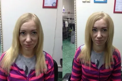 Процедура буст ап (boost up) для волосся з фото до і після (буст) Процедура буст ап (boost up) для волосся з фото до і після