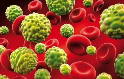 Рак крові виліковний чи ні у дорослих можна вилікувати, як лікувати (крові) Рак крові виліковний чи ні у дорослих можна вилікувати, як лікувати