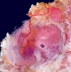 З чого починається життя людини - постабортний синдром - postabortion syndrome (життя) З чого починається життя людини - постабортний синдром - postabortion syndrome