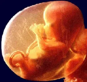 З чого починається життя людини - постабортний синдром - postabortion syndrome (починається) З чого починається життя людини - постабортний синдром - postabortion syndrome
