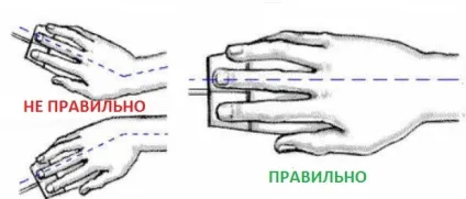 Синдром комп'ютерної миші або тунельний синдром (синдром комп'ютерної миші) Синдром комп'ютерної миші або тунельний синдром