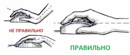 Синдром комп'ютерної миші або тунельний синдром (medportal надає послуги) Синдром комп'ютерної миші або тунельний синдром