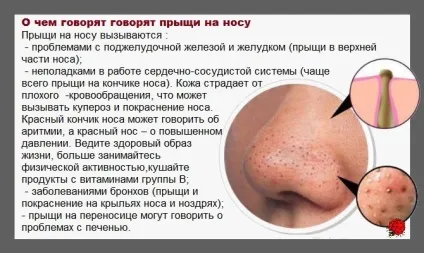 Висип на носі