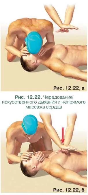 Порятунок на воді, школа плавання (боці залежності того) Порятунок на воді, школа плавання