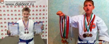 Спортивна стоматологія (боксерська каппа) спортивна стоматологія