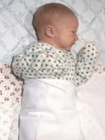Суха шкіра у новонародженого (суха) Суха шкіра у новонародженого