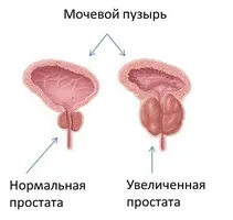 Гарбузова олія корисні властивості, застосування при простатиті (корисні) Гарбузова олія корисні властивості, застосування при простатиті