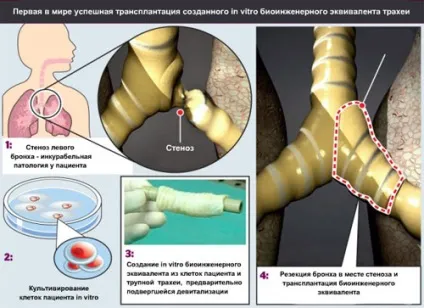 тканинна інженерія