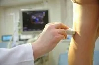Видалення тромбу або операція з видалення тромбу на нозі (тромбу) Видалення тромбу або операція з видалення тромбу на нозі