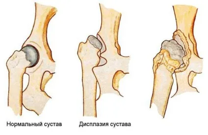 Качина хода - це ознака якогось захворювання ( «качиної ходи» «Качина) Качина хода - це ознака якогось захворювання
