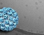 Види вугрів фото, стероїдні, кулясті (види) Види вугрів фото, стероїдні, кулясті