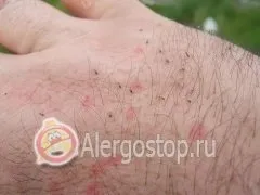 Алергія влітку - алергія у дорослих