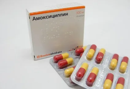 Антибіотики при отиті середнього вуха у дорослих (дорослих) Антибіотики при отиті середнього вуха у дорослих