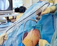 Вивих плечового суглоба симптоми, лікування і операція, вправи для реабілітації суглоба плеча (суглоба) Вивих плечового суглоба симптоми, лікування і операція, вправи для реабілітації суглоба плеча