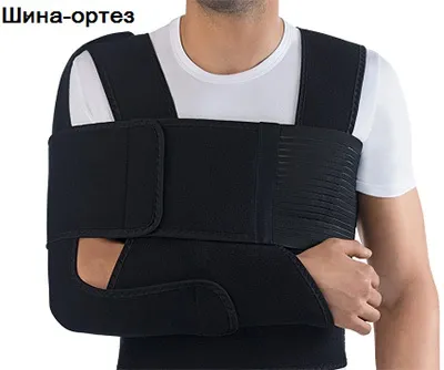Вивих плечового суглоба симптоми, лікування і операція, вправи для реабілітації суглоба плеча (вивих) Вивих плечового суглоба симптоми, лікування і операція, вправи для реабілітації суглоба плеча