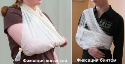 Вивих плечового суглоба симптоми, лікування і операція, вправи для реабілітації суглоба плеча (вивих) Вивих плечового суглоба симптоми, лікування і операція, вправи для реабілітації суглоба плеча